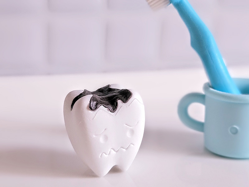 むし歯・被せ物